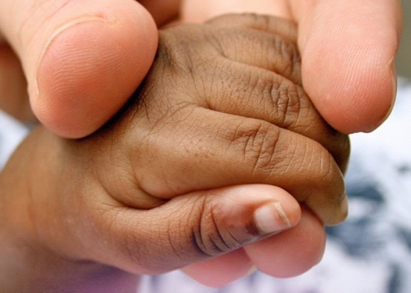 «Se nasce prematuro, si deve aiutare un bambino a vivere»